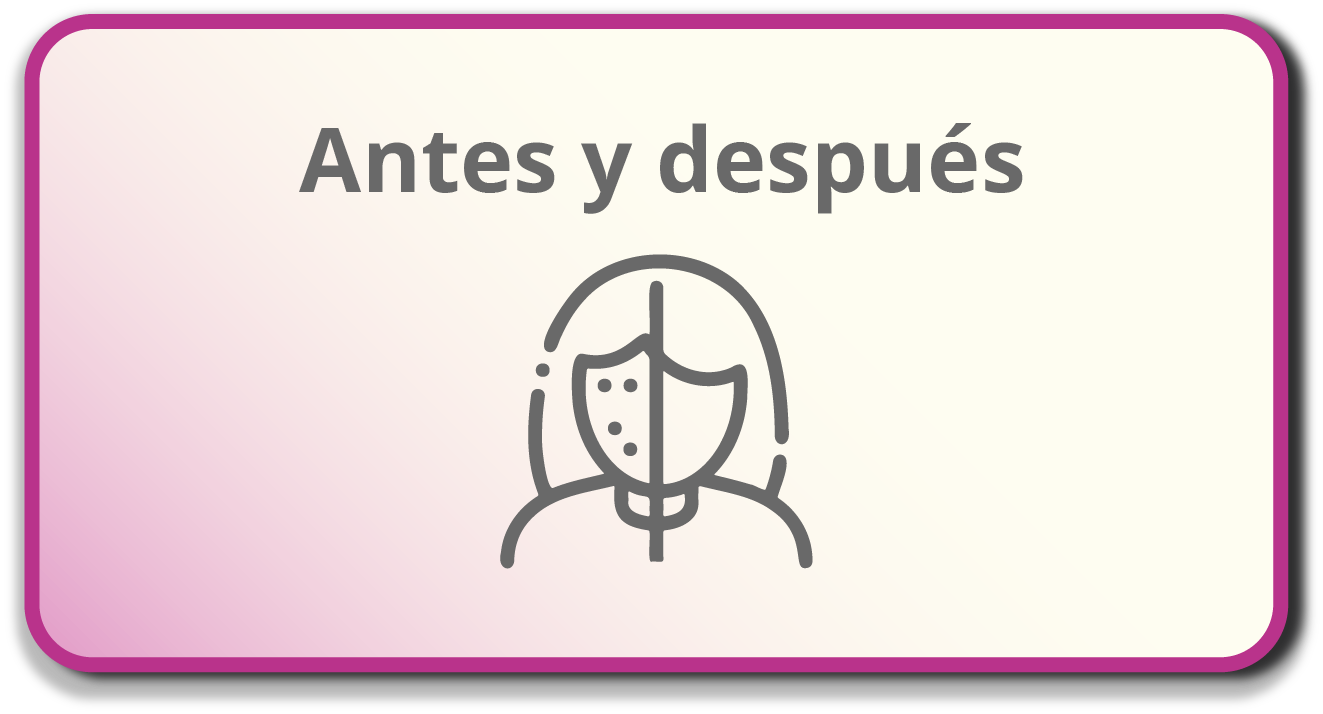 Antes y después